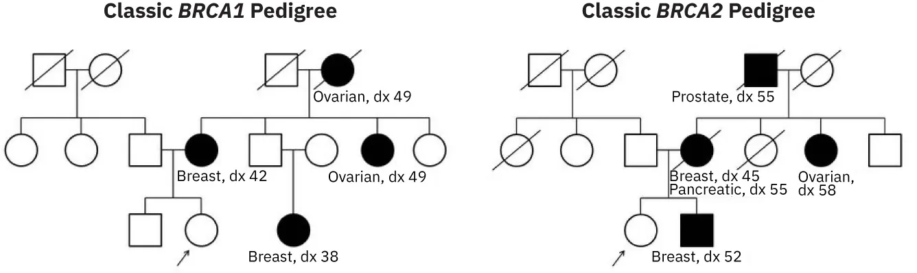 Diagram of Classic BRCA1 Pedigree, labeling Ovarian, dx 49, Breast, dx 42, and Breast, dx 38; diagram of Classic BRCA2 Pedigree, labeling Prostate, dx 55, Breast, dx 45, Pancreatic, dx 55, Ovarian, dx 58, and Breast, dx 52