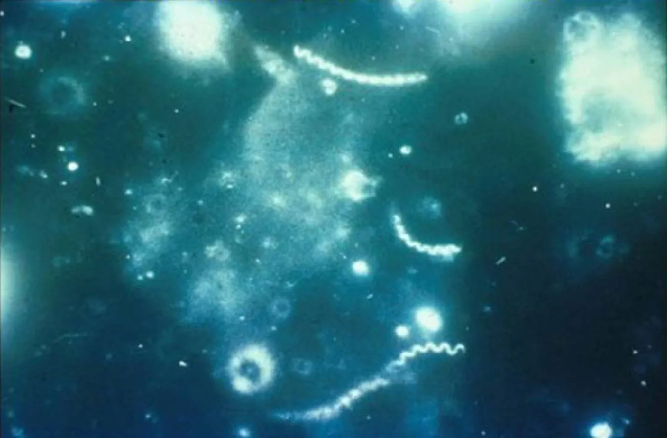 Image of Treponema pallidum, the bacteria that cause syphilis.