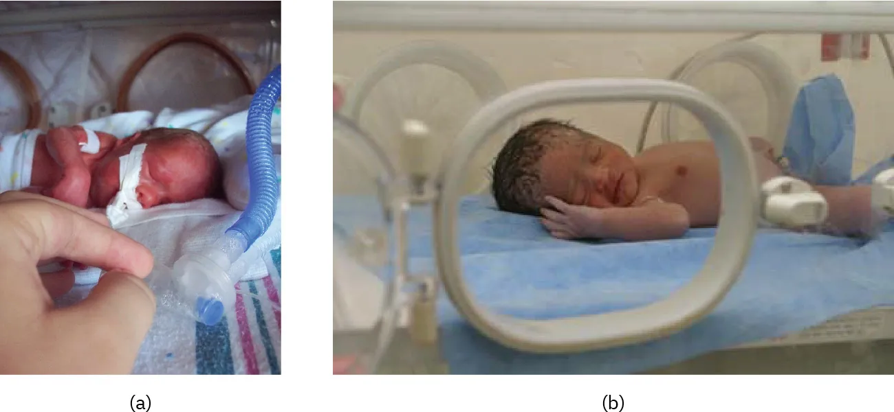 Photo of (a) infant on ventilator in hospital setting and (b) infant in incubator in hospital setting.