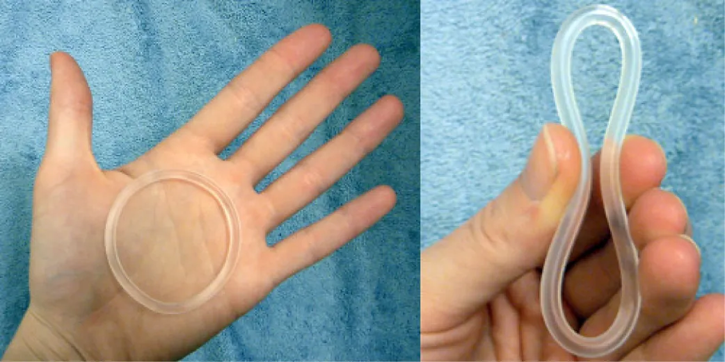 Image of (left image) contraceptive vaginal ring pictured on a hand and (right image) being compressed by fingers.