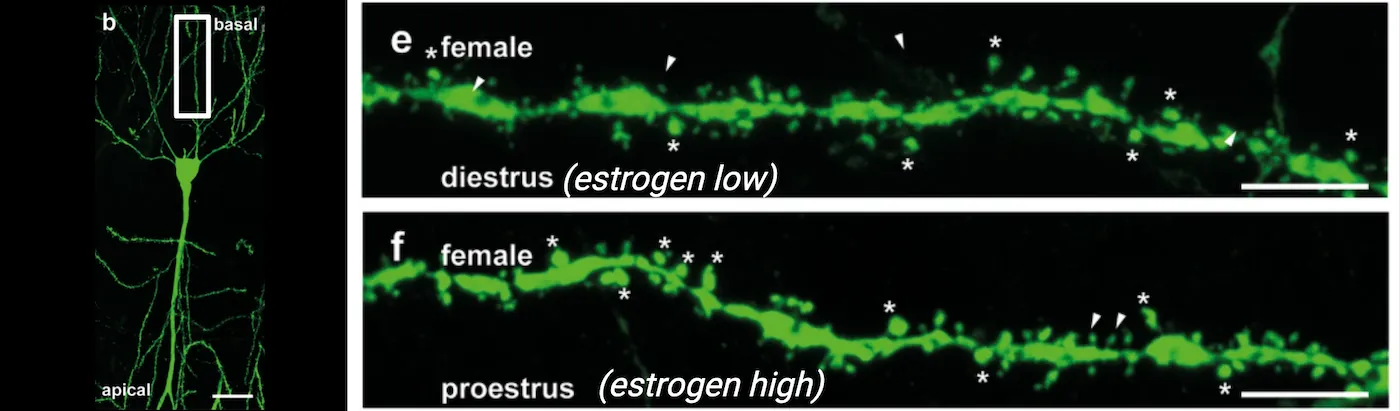 A neuron (left) and magnified dendrites from female mice in diestrus (low estrogen) and proestrus (high estrogen). Spines (*) increase, and filopodia (arrowheads) decrease with high estrogen levels.