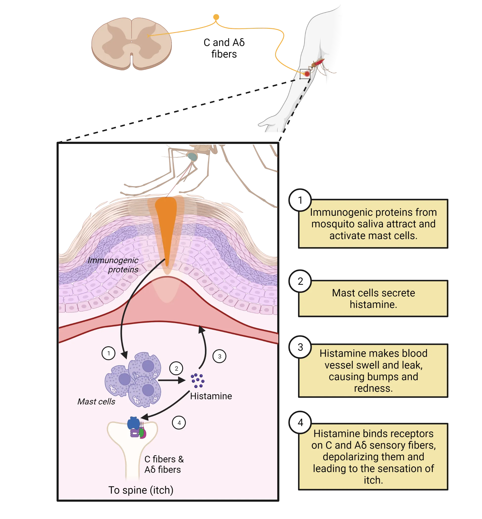 Cross-section of skin with a swollen bump beneath a mosquito. Within the skin, blood vessel is swollen and mast cells are shown releasing histamine that activates swelling and C & Adelta fiber activity arrow right to itch