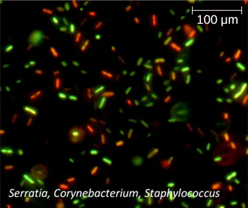 A micrograph of many glowing green cells and some glowing red cells.