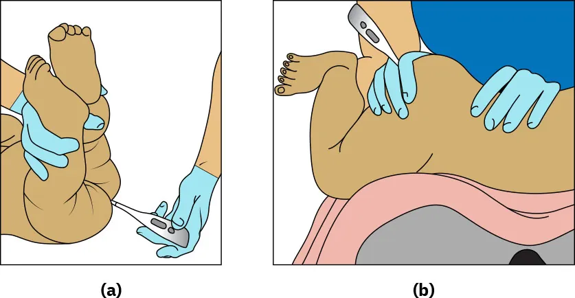 Diagram showing two positions for taking rectal temperature of infant or child under the age of 2: (a) child on back, (b) child on stomach over nurse’s knees.