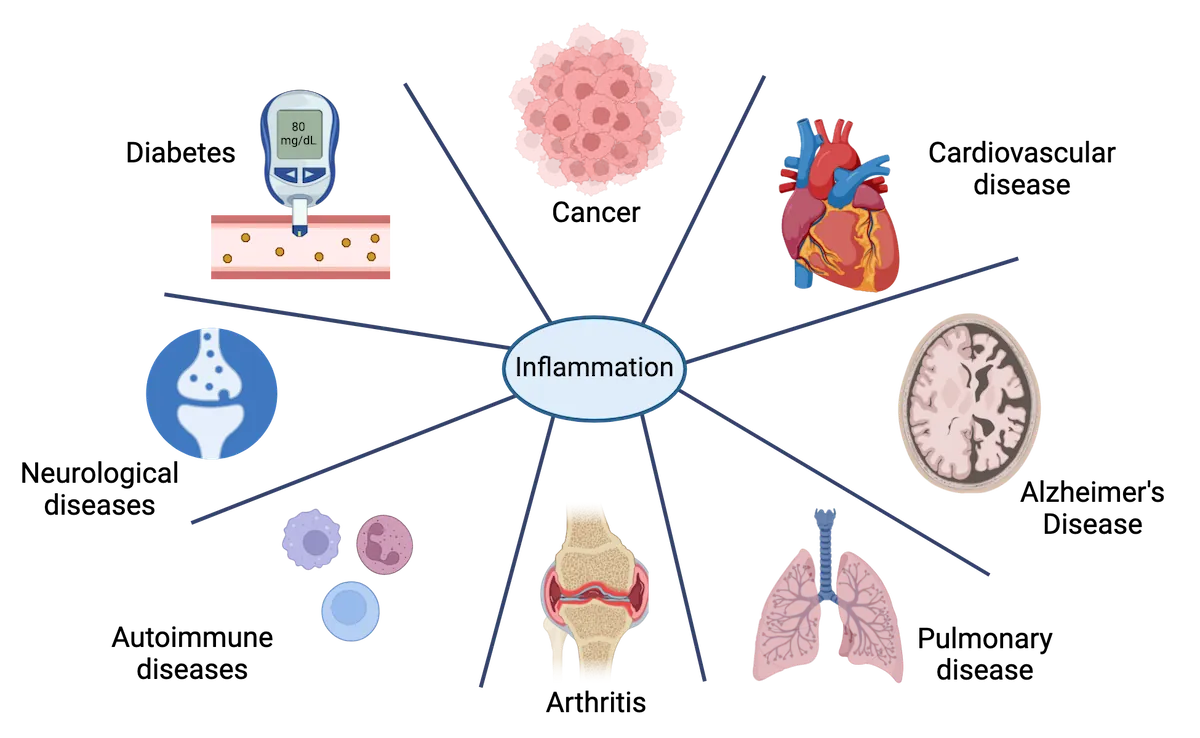 A diagram with the word “inflammation” in the middle, surrounded by pictures meant to represent: diabetes, cancer, cardiovascular, Alzheimer’s disease, pulmonary disease, arthritis, autoimmune diseases, neurological diseases.