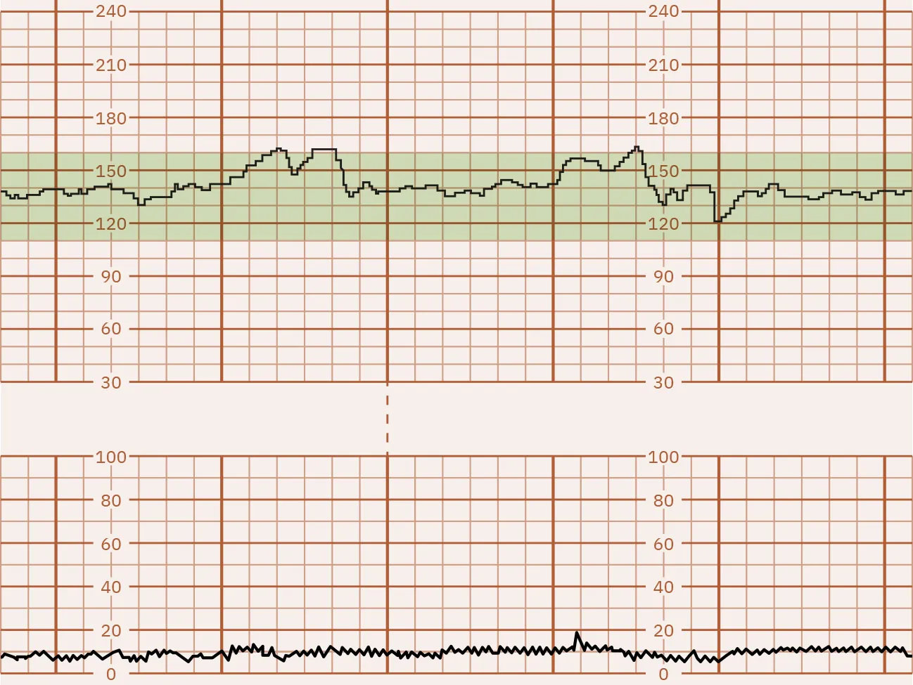 Fetal heart rate reading indicating moderate variability.