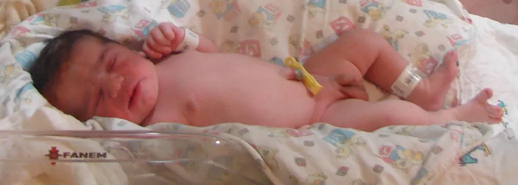 Photo of newborn with an umbilical clamp and wrist and leg tags in a hospital bassinet.