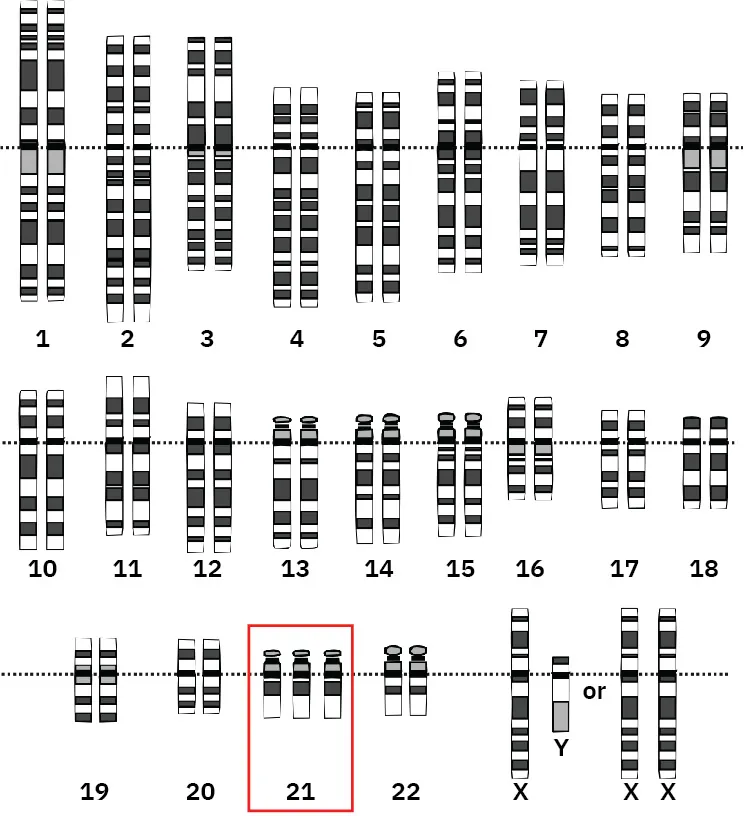 Illustration of chromosomes depicting an extra chromosome at the 21st chromosome.