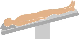 A diagram showing the Trendelenburg position.