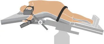 A diagram showing the kidney position.