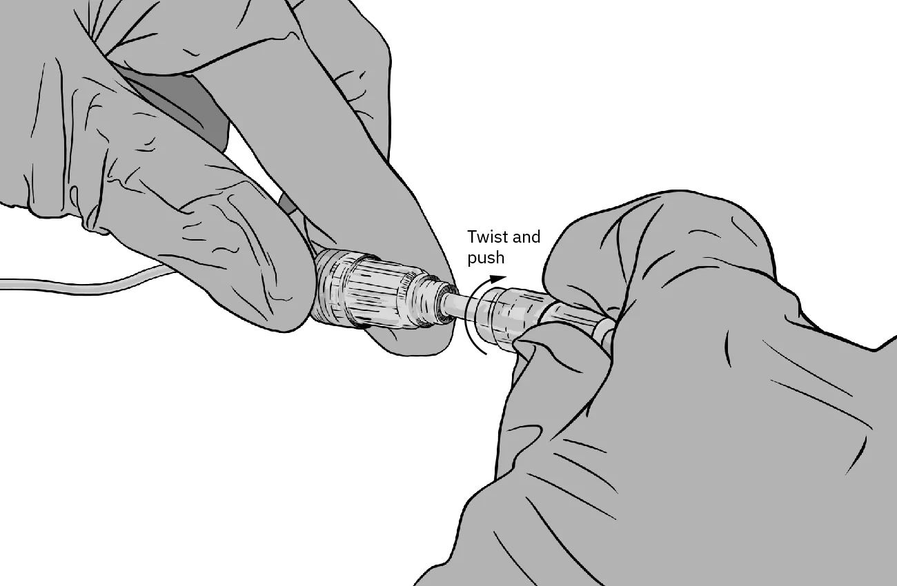 Fingers wearing latex gloves attach a syringe to a saline lock. Tubing attached to the saline lock is taped to the patient's arm.