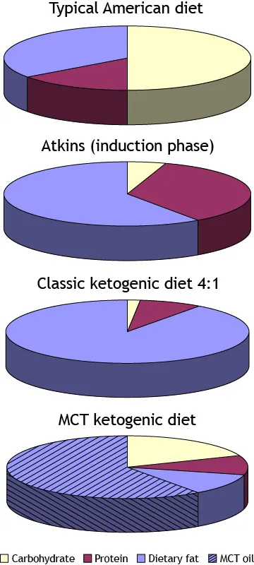 Four pie charts show the percentages of carbohydrates, proteins, dietary fat, and M C T oil in 4 different diets. The American diet consists of about 50 percent carbohydrates, 33 percent dietary fat, and 17 percent protein. The induction phase of the Atkins diet consists of more than 50 percent dietary fat, about 33 percent protein, and a very small amount of carbohydrates. The classic ketogenic diet contains about 80 percent  dietary fat, a small amount of protein, and a very small amount of carbohydrates. The M C T ketogenic diet contains slightly more than 50 percent M C T oil and about 25 percent carbohydrates, with the remaining amount split evenly between protein and dietary fats.