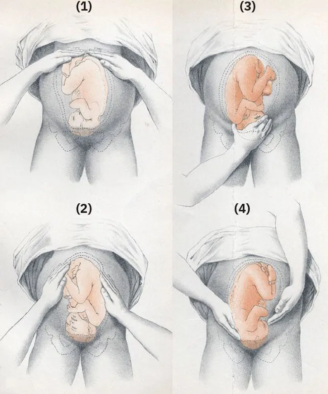 Diagram showing Leopold Maneuvers: (1) both hands palpate top of abdomen; (2) hands slide down to sides of uterus; (3) hand held in a "C" as thumb and fingers grasp fetal part in low abdomen above pubic bone; (4) both hands palpate down the sides of the uterus to the pubic bone and presenting part.