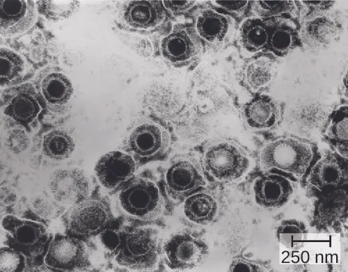 Micrograph of round structures.