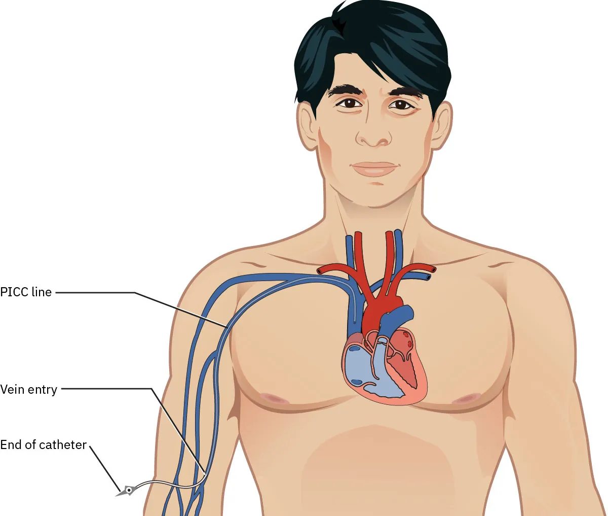 A diagram shows a head and torso with the heart and catheter shown. The labels include “PICC line,” “vein entry,” and “end of catheter.”