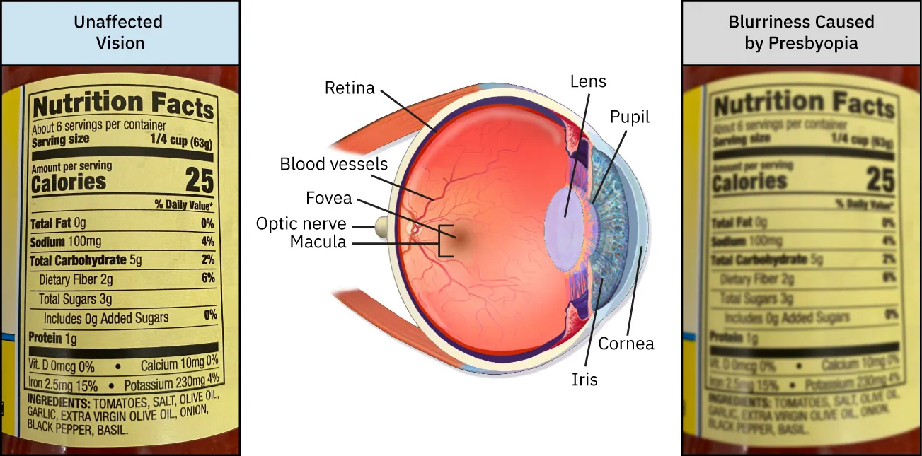 Food label visible as Unaffected Vision and as Blurriness Caused by Presbyopia. Illustration of eye with labeled parts in the middle.