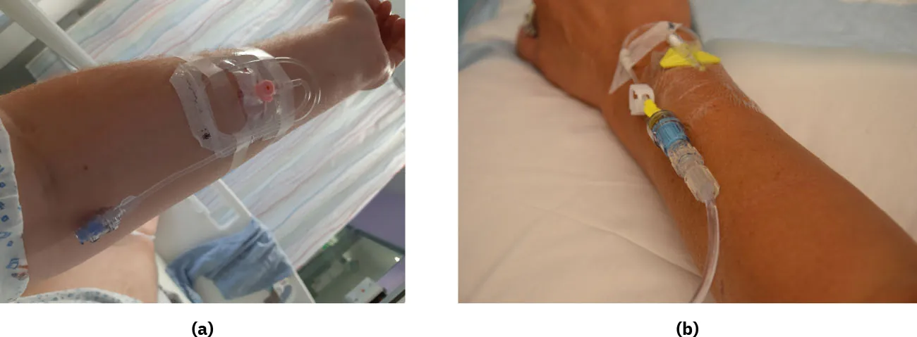 A two-part image showing (a) a cannula and (b) a saline lock.
