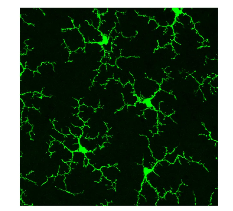 Fluorescent image of green microglial cells, which have a small, central cell body with many branch-like processes extending out from it in all directions.