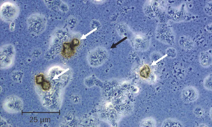 Micrograph showing oddly (roughly round) shaped structures.