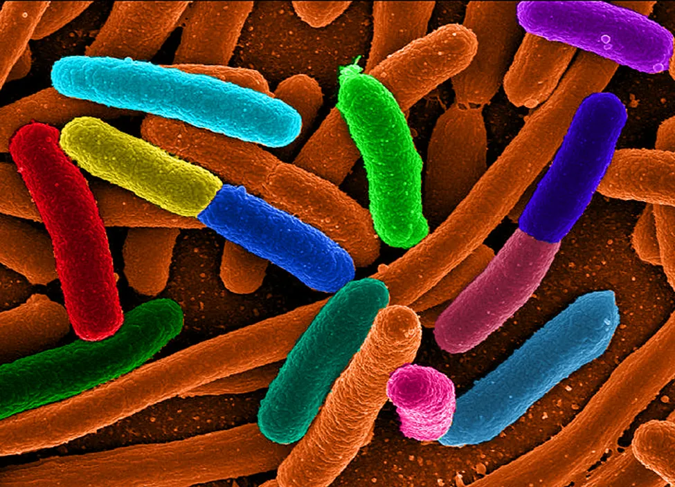 La bacteria Escherichia coli (e Coli)