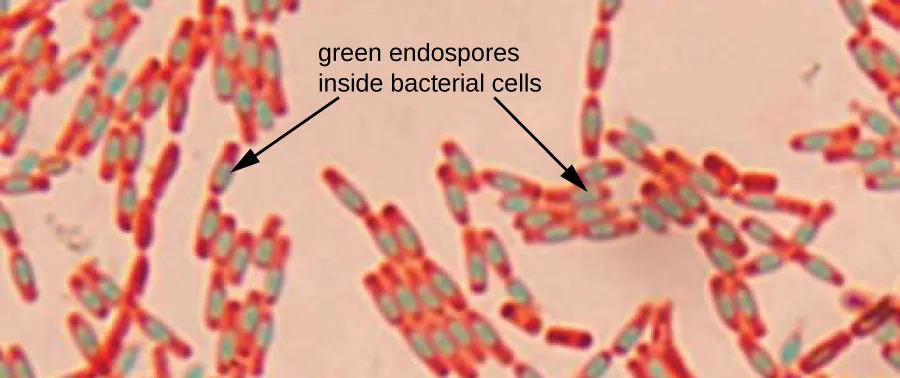 A micrograph shows chains of red rods. Each red rod contains a green oval. An arrow pointing to the green ovals states: green endospore inside bacterial cells.