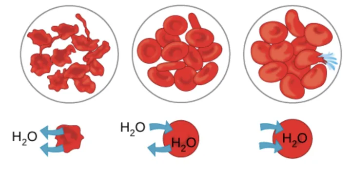 The left part of this illustration shows shriveled red blood cells bathed in a hypertonic solution. The middle part shows healthy red blood cells bathed in an isotonic solution, and the right part shows bloated red blood cells bathed in a hypotonic solution.