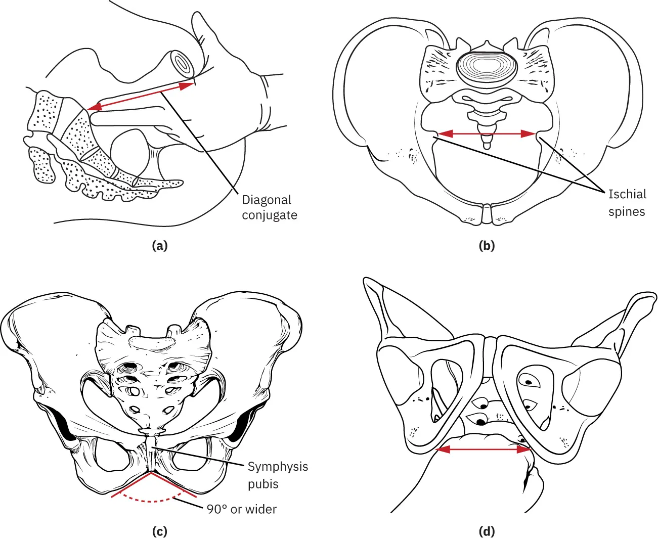Diagram of clinical pelvimetry showing (a) assessment of diagonal conjugate by inserting two fingers into vagina, (b) location of ischial spines, (c) location of symphysis pubis showing 90 degrees or wider pubic arch, and (d) fist measuring intertuberous diameter.