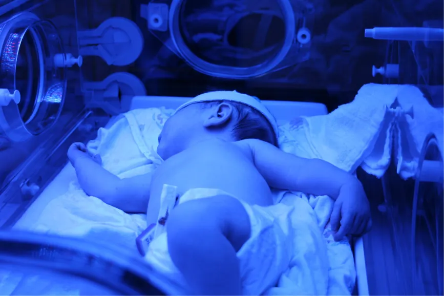 Jaundiced newborn under bili light.