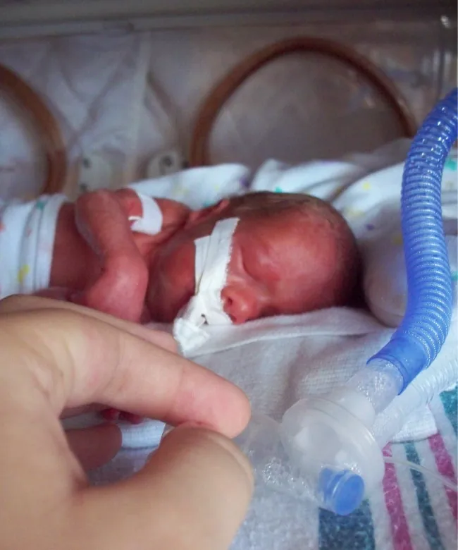Photo of preterm infant in hospital cradle.