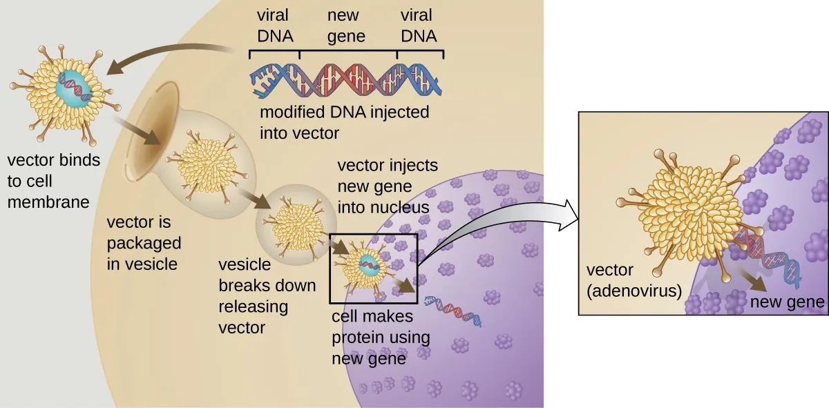 A diagram of gene therapy. A virus vector contains modified viral DNA that includes an inserted gene. First the vector binds to the cell membrane. The vector is then packaged in a vesicle. The vesicle then breaks down releasing the vector. The cell now makes protein using the new gene.