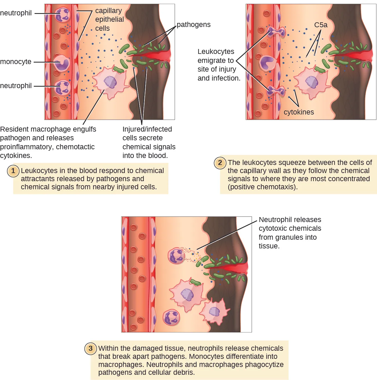 A diagram with 3 steps. The first step states: leukocytes in the blood respond to chemical attractants released by pathogens and chemical signals from nearby injured cells. An injury to the surface of the skin is labeled: injured/infected cells secrete chemical signals into the blood. Pathogens are present in the wound. Neutrophils and monocytes are in the blood stream; and the outside of the vessel is labeled capillary epithelial cells. A resident macrophage engulfs the pathogens and releases proinflammatory chemotactic cytokines. The second step states: the leukocytes squeeze between the cells of the capillary wall as they follow the chemical signals to where they are most concentrated (positive chemotaxis). The leukocytes emigrate to the site of injury and infection. The chemical signals present include C5a and cytokines. The third panel states: Within the damaged tissue, neutrophils release chemicals that break apart pathogens. Monocytes differentiate into macrophages. Neutrophils and macrophages phagocytize pathogens and cellular debris. Neutrophils release cytotoxic chemicals from granules into tissue.