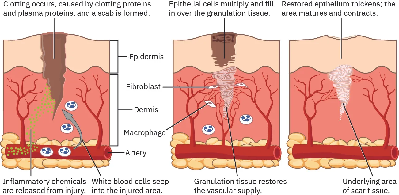 The three major phases a wound goes through while healing.