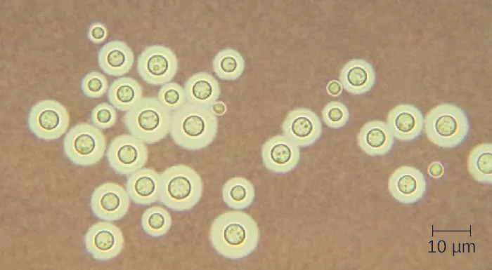 Micrograph of circles with rings around them.