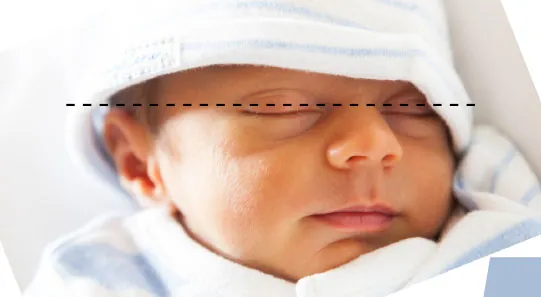 Photo of infant sleeping. Dotted line shows top of ear lines up with middle of eyes.