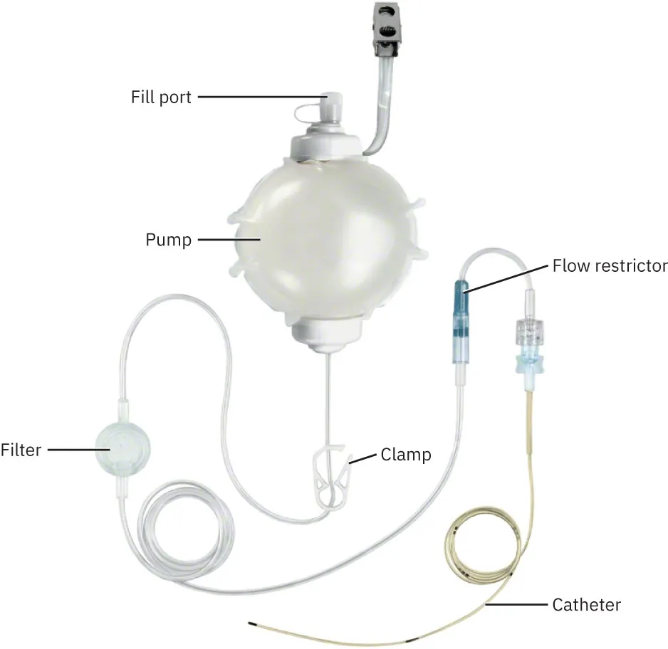Pain pump catheter with pump, flow restrictor, filter, clamp, and catheter labeled.