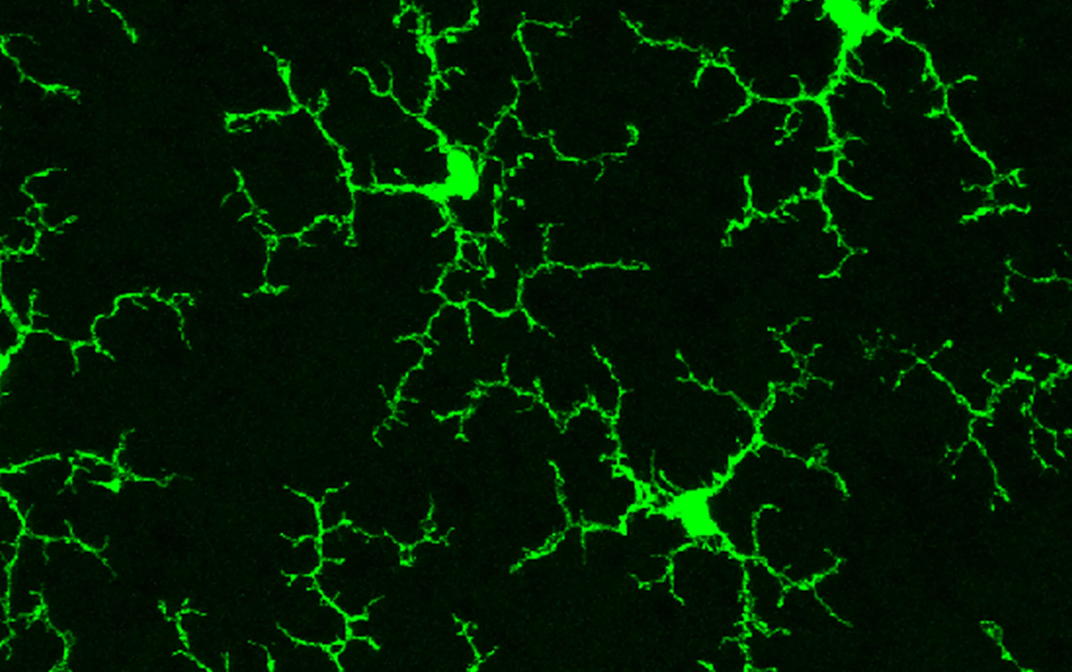 Microglia appear in this micrograph as green branching endrils on a black background.