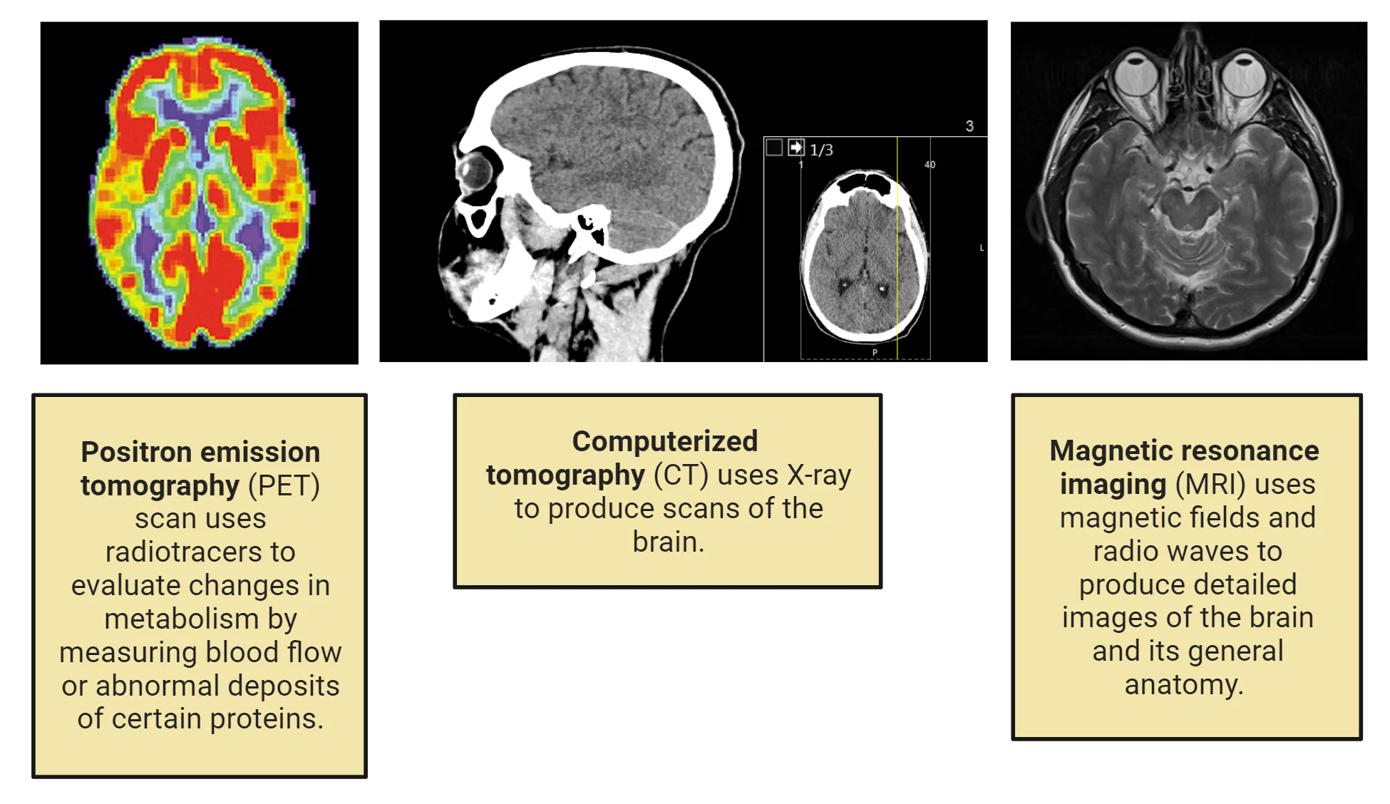 Representative images of a PET scan, CT scan and MRI of a human brain. The basic methodology is summarized from the main text