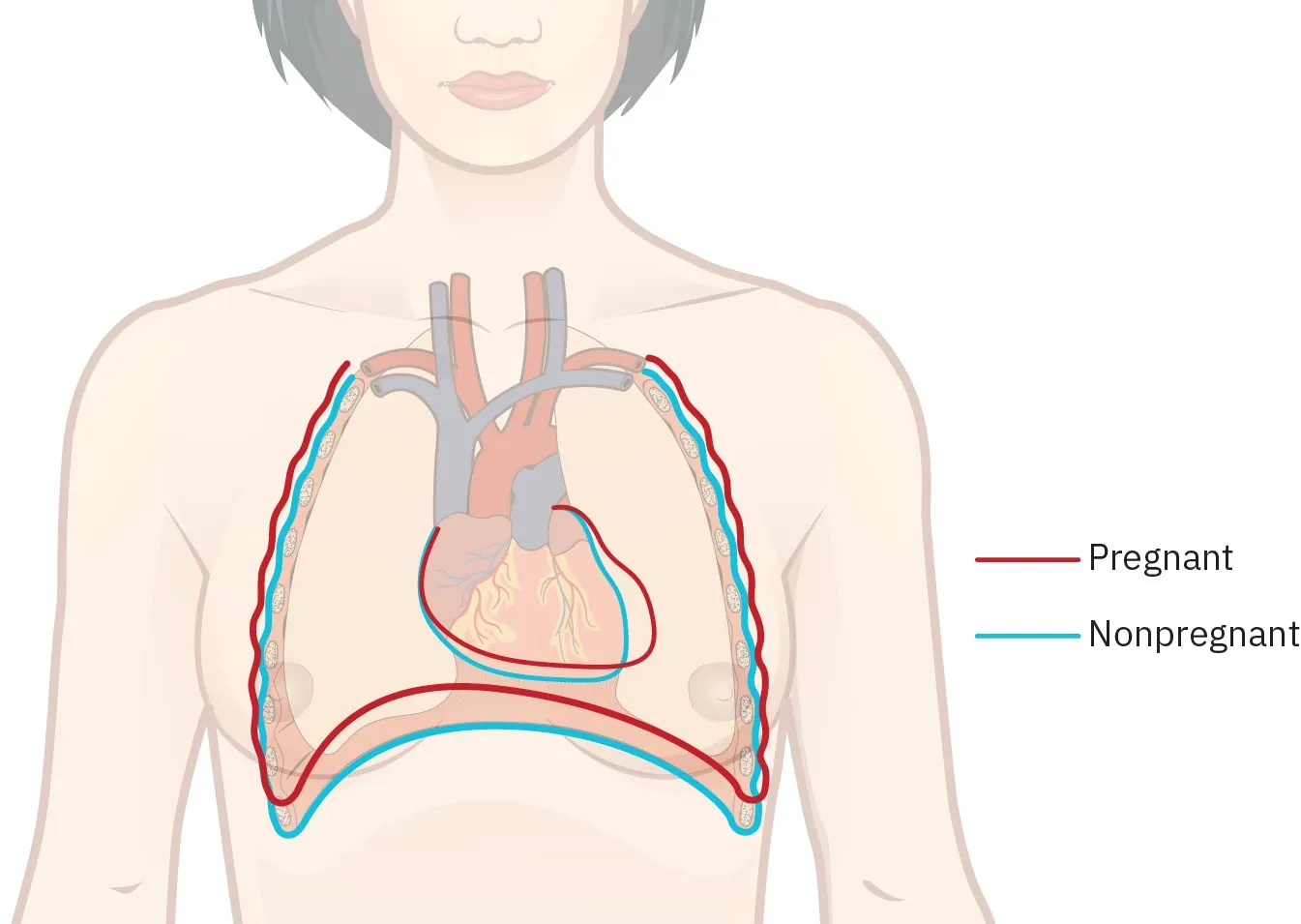 An illustration of a woman’s thorax, ribs, and heart. It includes lines indicating how the diaphragm rises and displaces the heart to the left when pregnant.