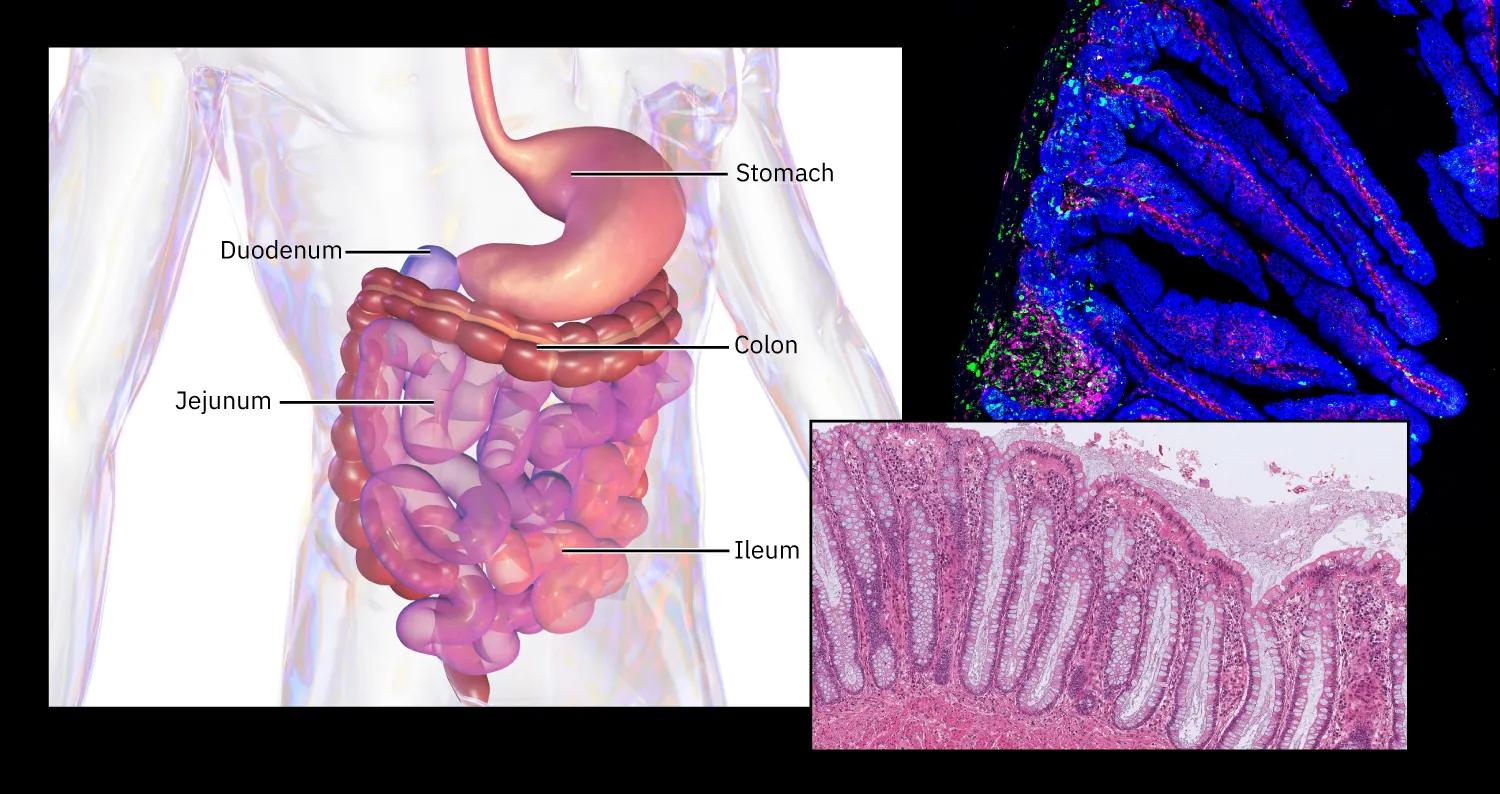 Illustration (left) of digestive system. Stomach, duodenum, colon, jejunum, ileum labeled. Image (top right) shows inside of small intestine at a steady state. Image (bottom right) of micrograph of colon’s simple columnar epithelium and goblet cells.