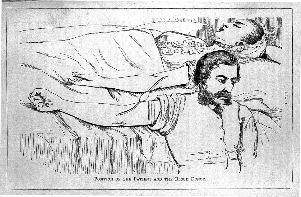 An illustration shows a woman lying in bed with her eyes closed and her arm at her side. A man is seated on the floor with his back against the bed and his arm extended on top of the bed. A tube runs from the man’s arm to the woman’s arm, transfusing his blood to her.