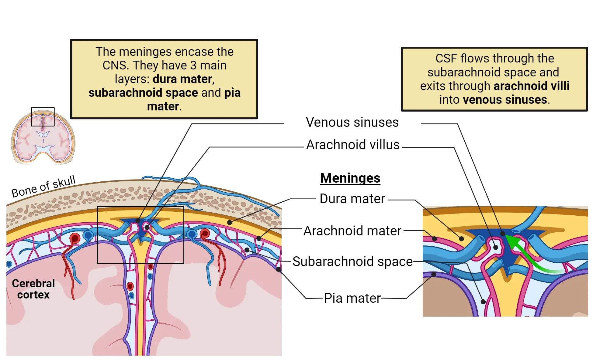 Diagram of the meninges with pia mater closely following the contours of the human brain. Exterior to that is subarachnoid space filled with blood vessels, enclosed above by arachnoid mater. Dura mater is the thickest layer, abutting the arachnoid mater interior and skull to the exterior. A zoom in shows the arachnoid space draining via arachnoid villus into a venous sinus.