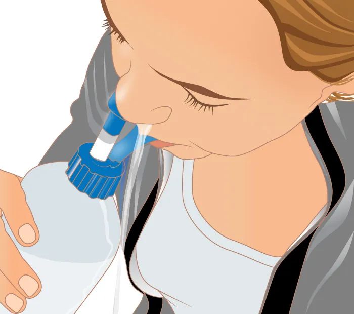 An illustration of a person squirting nasal wash into one nostril as it drains from the other nostril.