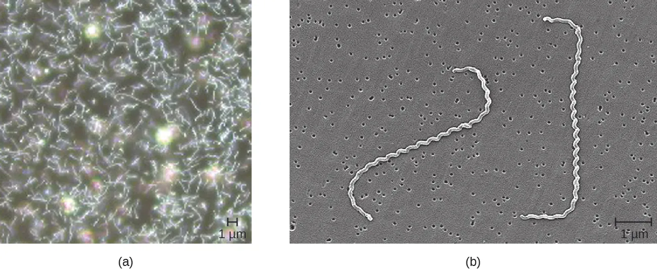 (a) Micrograph of many spiral shaped cells. (b) Higher magnification showing spiral shape more clearly.