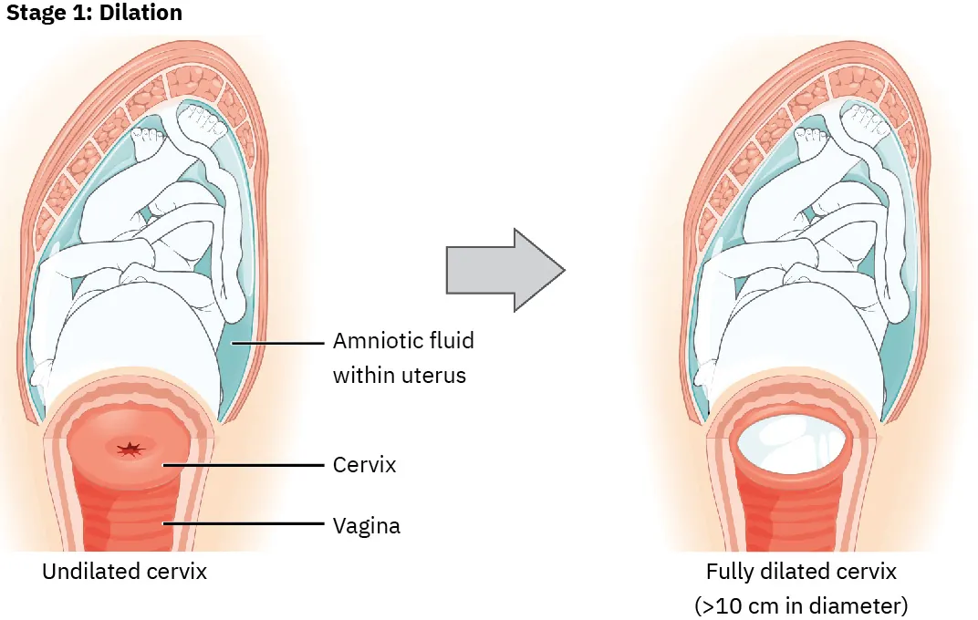 Illustration of fetus in uterus with undilated cervix. Image of fetus in uterus with fully dilated cervix (>10 cm in diameter).
