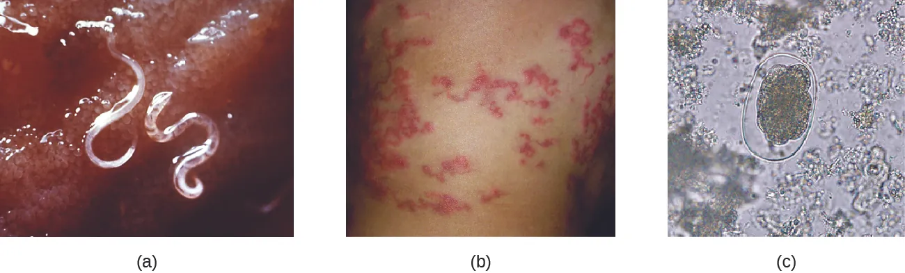 a) photo of a cler worm attached to tissue. B) photo of red lines in the skin. c) Micrograph of an oval structure.
