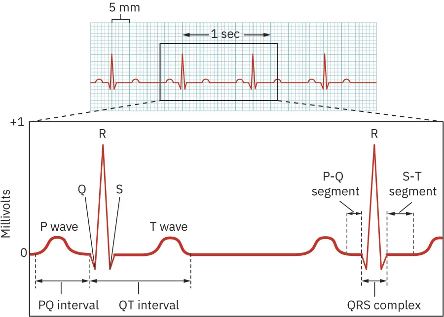 An image of electrocardiogram reading.