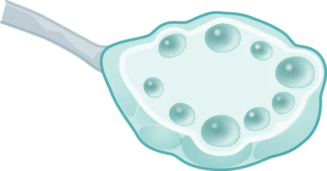 Image of ovary with small follicles.