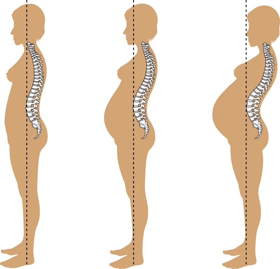 A simple three-panel illustration of a pregnant woman showing her spine as it changes in curvature. The spine’s curvature increases as the pregnancy develops.