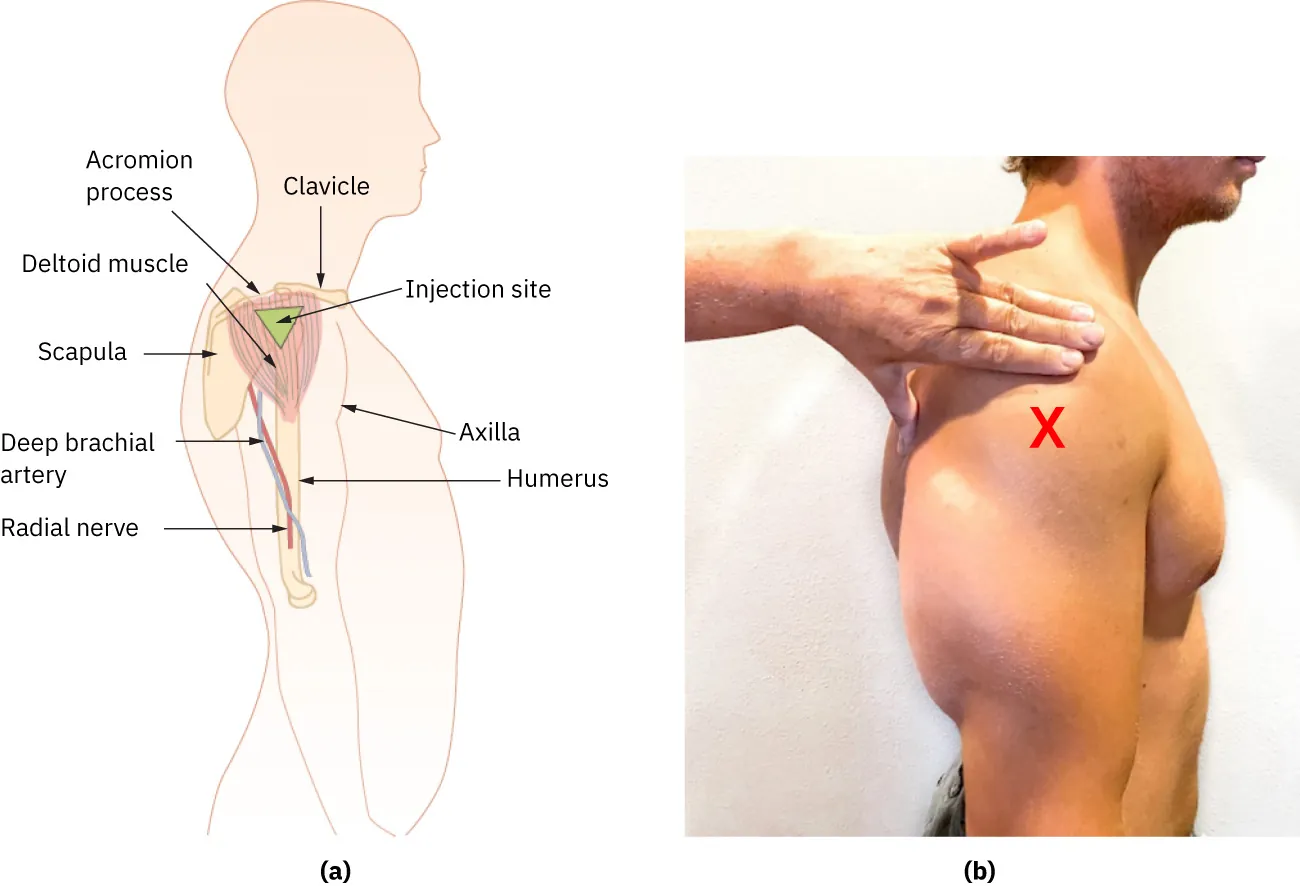 (a) Diagram labeling acromion process, deltoid muscle, scapula, deep brachial artery, radial nerve, clavicle, injection site, axilla, humerus, (b) a photograph shows a hand locating deltoid muscle on a male patient.