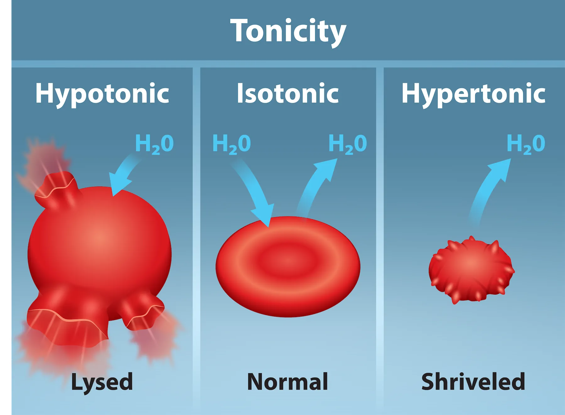 The left part shows bloated red blood cells, lysed, bathed in a hypotonic solution. The middle part shows healthy red blood cells bathed in an isotonic solution, and the right part of this illustration shows shriveled red blood cells bathed in a hypertonic solution.